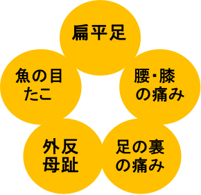 足部のアライメント異常